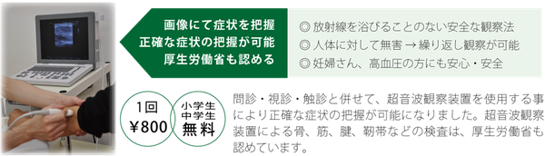 超音波観察装置